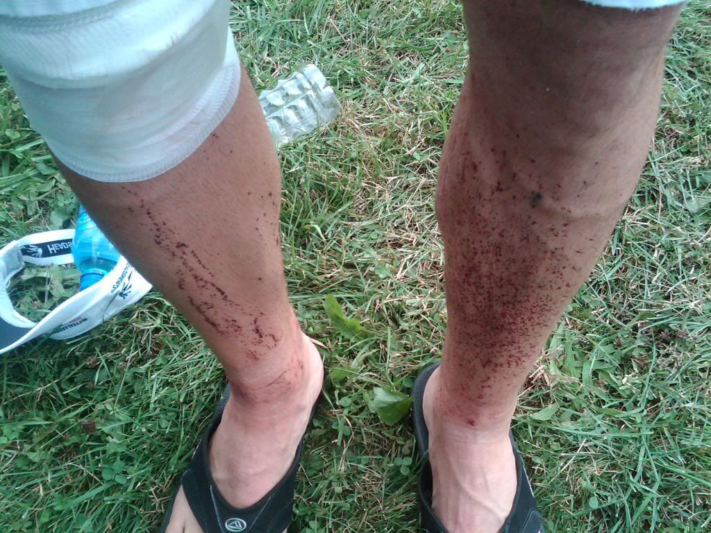 http://i197.photobucket.com/albums/aa48/chrisgleason/Cuse/leg-1.jpg