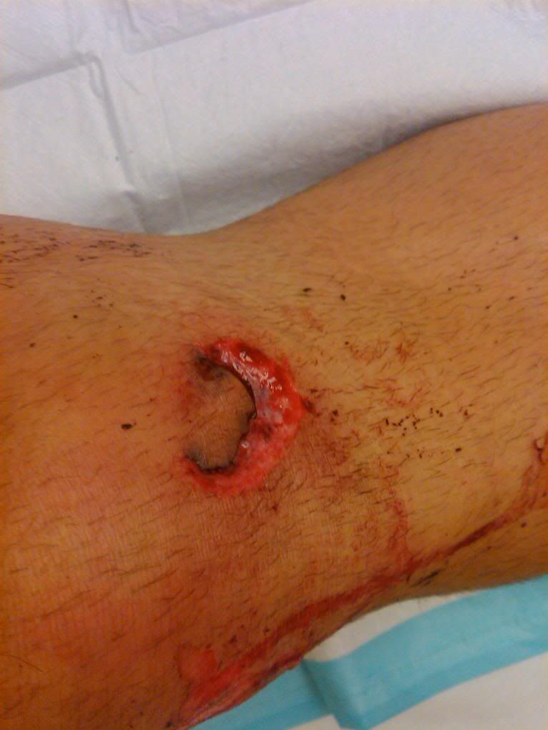 http://i197.photobucket.com/albums/aa48/chrisgleason/Cuse/legopen-1.jpg